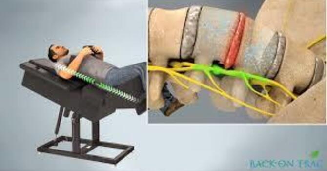 Spinal Decompression (Ergo-Flex Technologies)